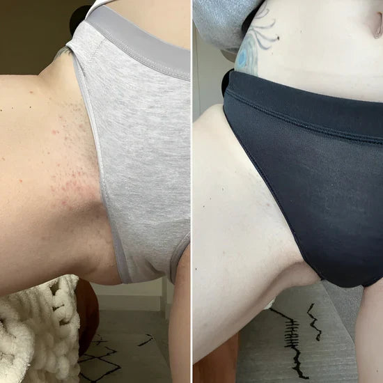 Slät hud utan irritation